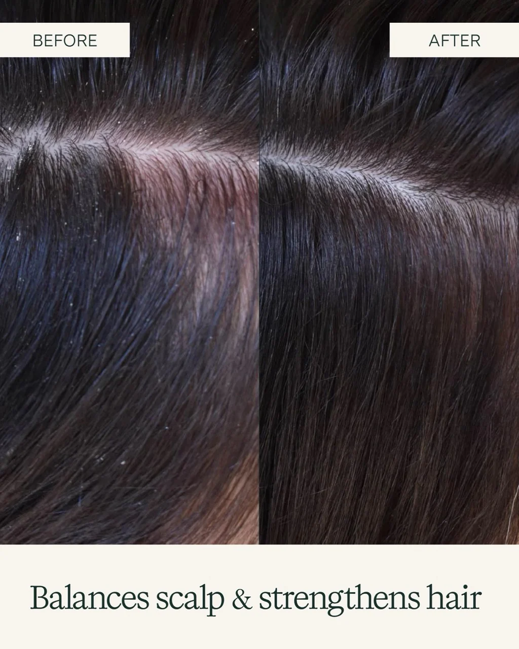 The Scalp Care bundle - Image 6